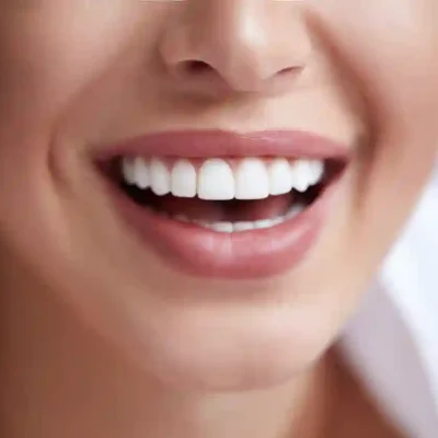 Cosmetic dentistry